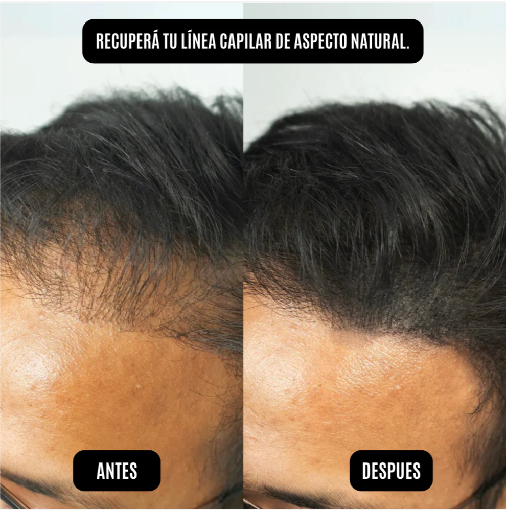 OnHair - Polvo Capilar Rellenardor